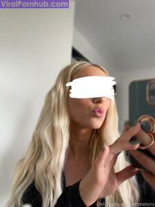 WettMelons Hot Onlyfans leaks - Most Bought Albums