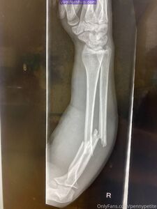 Pennypetite Onlyfans Neueste Nacktfotos Durchgesickert